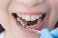 зъболекар Русе - 32081 - вижте нашите предложения